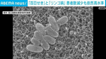 「百日せき」患者数 6週間ぶりに減少も依然高い水準