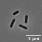 「薬剤耐性菌」も“顔認証”　形で見分け、太く短く変化