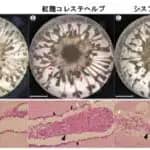 腎臓の構造を再現した「ミニ腎臓」で動物を使わずに薬の毒性を評価　岡山大学