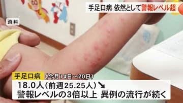 “マイコプラズマ”も再び増加…手足口病の患者数は依然として警報レベルの3倍超 富山で異例の流行続く